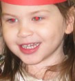 /album/bilder-prog-8/red-eye-jpg/